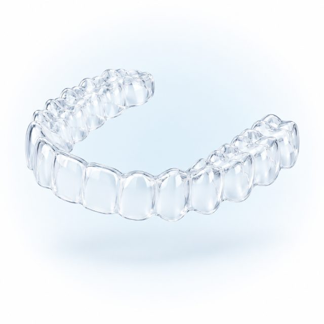 Illustration en 3D d'une gouttière d'alignement transparente